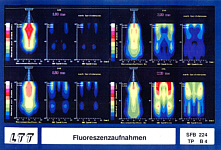 Fluoreszenzaufnahmen